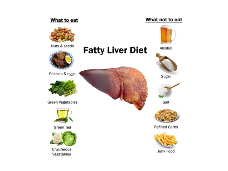 Fatty Liver Diet - Foods to Eat and Avoid - HealthyCrispy